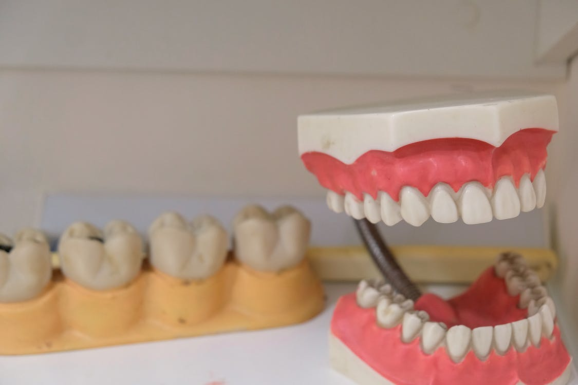 You are currently viewing Types of Dentures You Should Know About