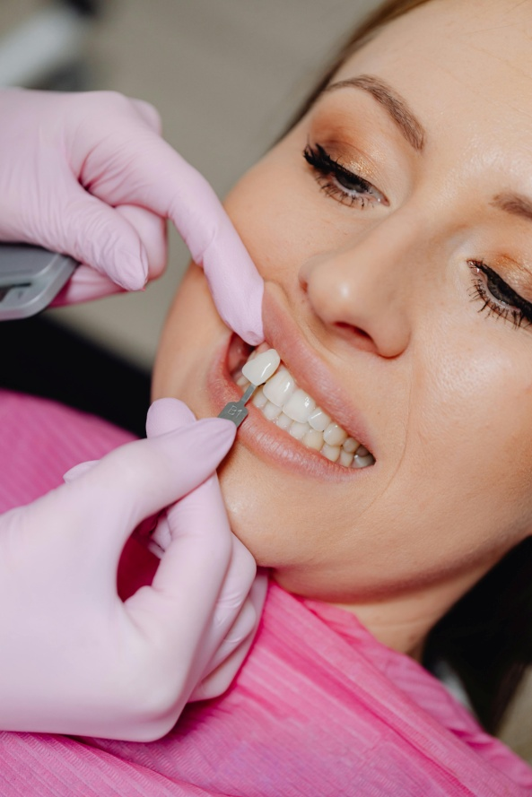 A dentist applying Veneer tooth on a patientImage File name: Patient-veneers