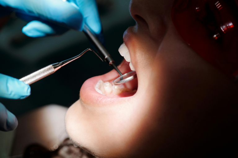 Read more about the article Preparing for a Fluoride Treatment: A Simple Guide