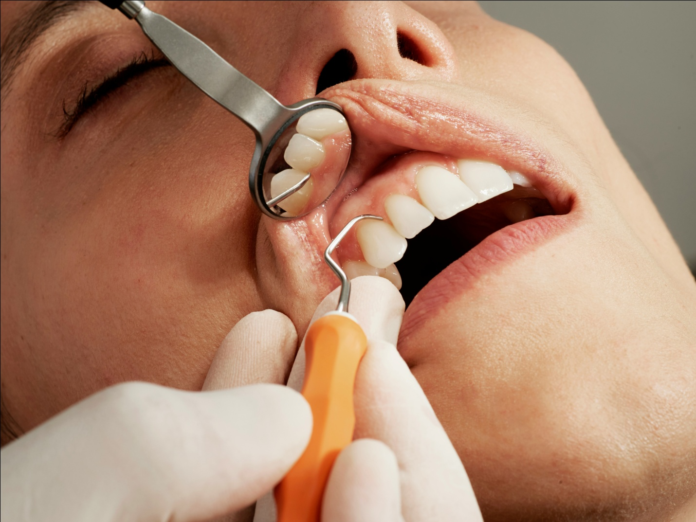 close up of a mouth being inspected using dental tools