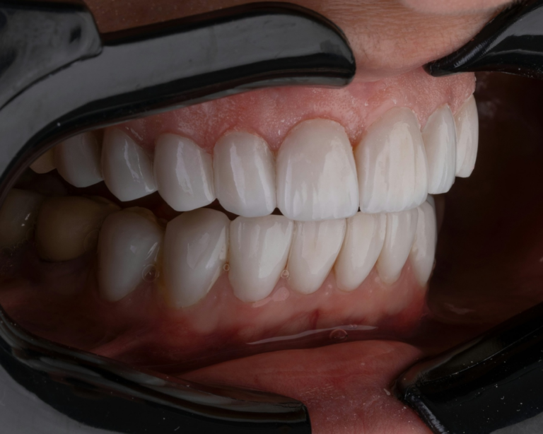 Read more about the article 4 Dental Problems and their Preventative Measures