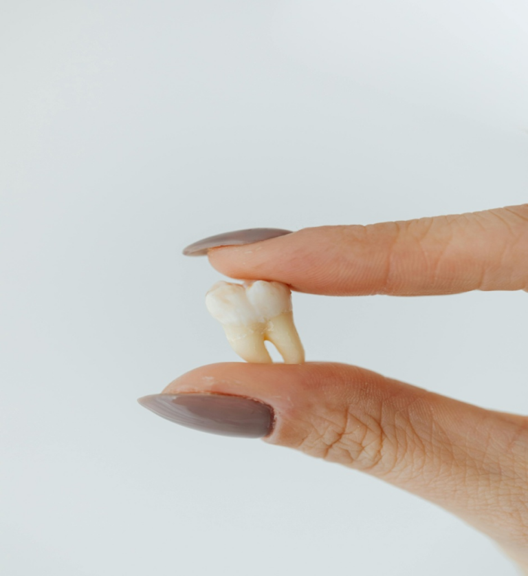 Read more about the article From Baby Teeth to Wisdom Teeth: A Journey Through Dental Development