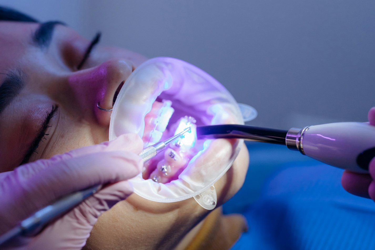 a person wearing braces getting their dental check-up