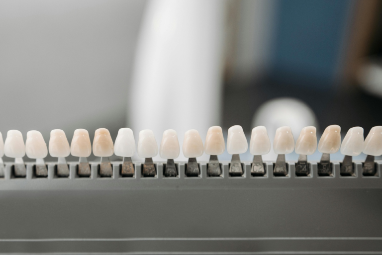 Read more about the article The Phases of Teeth Whitening: A Comprehensive Timeline