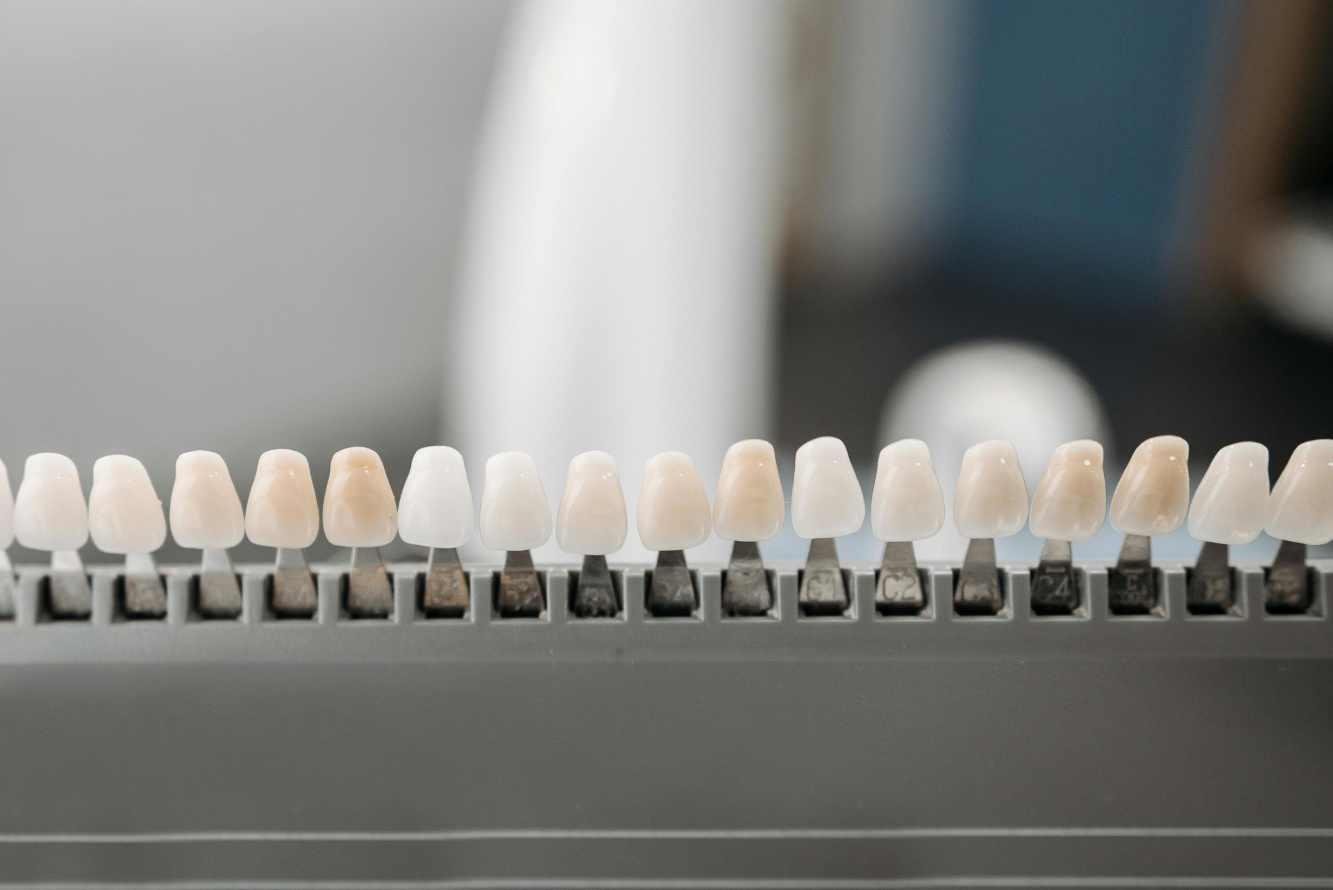 You are currently viewing The Phases of Teeth Whitening: A Comprehensive Timeline