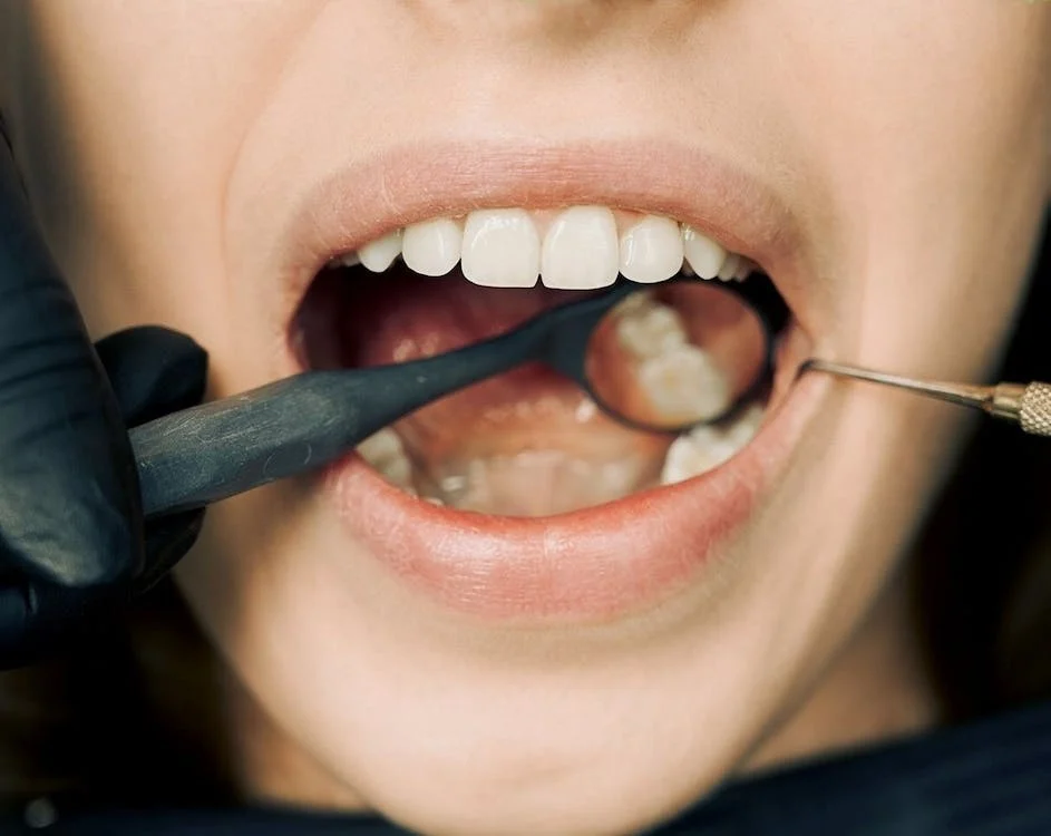 An image of a person getting their teeth checked out