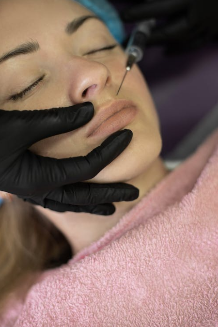 A woman receiving a lip injection with dermal fillers from a professional wearing black gloves.