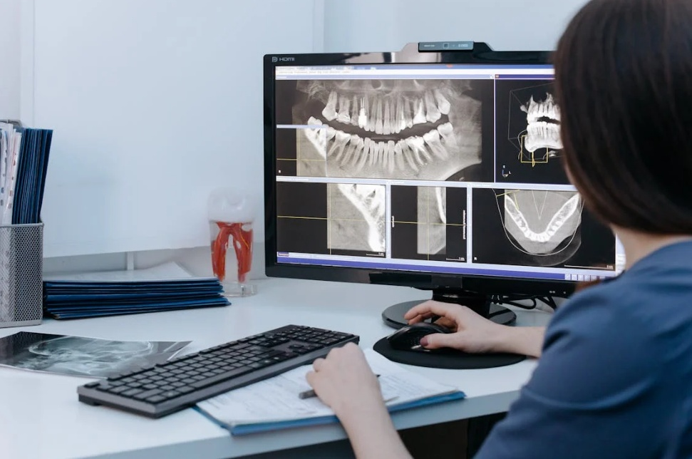 Read more about the article The Advantages of Digital X-Rays in Dental Diagnostics