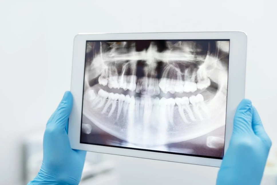 Gloved hands holding a tablet displaying a digital dental X-ray