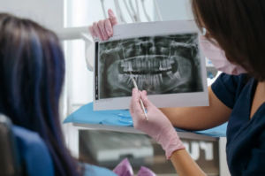 a dentist showing an x-ray image of teeth to a patient